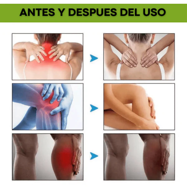 BeeVana™ Alivia su Dolor con una Acción Rápida - ENVÍO GRATIS A TODA COLOMBIA!!